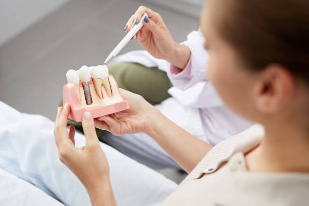 Materiale folosite în implanturile dentare: Alegerea potrivită pentru un zâmbet durabil